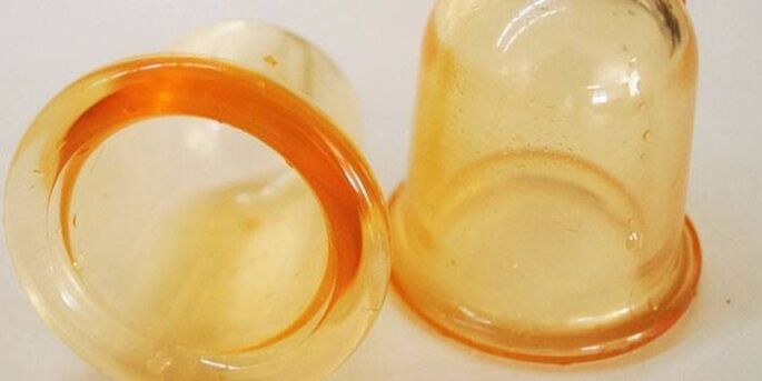 шклянкі для лячэння прастатыту